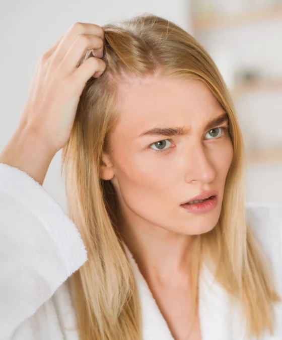 mese_del_capello_GWE_1 Prevenire la caduta: cosa puoi fare ora per proteggere i tuoi capelli
